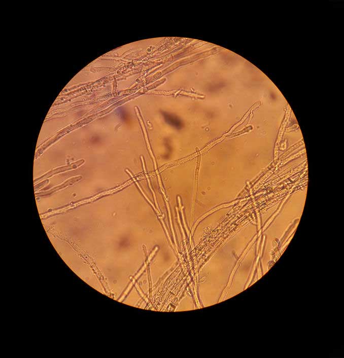 Mycelium under a microscope. Mycelium under a microscope.